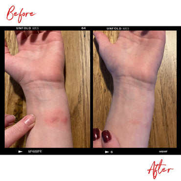 Images of a boy's hands before and after using Clemence Organics skin care products.