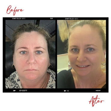 Images of a woman's face before and after using Clémence Organics skin care products.