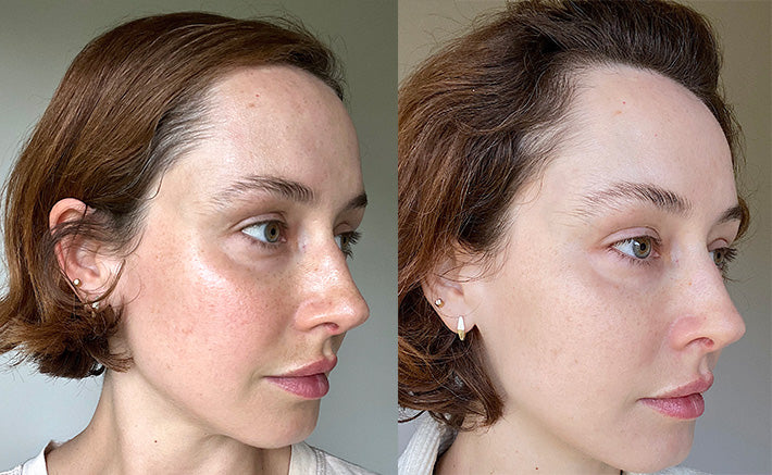 The Best Transformations in Australian Skincare: Before & After Stories