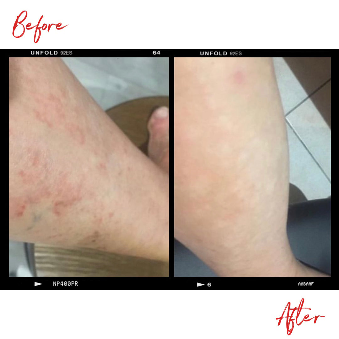 Images of a woman's legs before and after using Clémence Organics skin care products.
