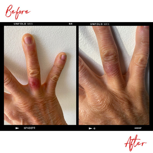 Images of a woman's hands before and after using Clémence Organics Ultimate SOS Balm. In the after image the quality of the woman's skin has improved significantly.